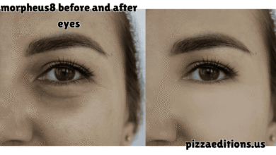 morpheus8 before and after eyes